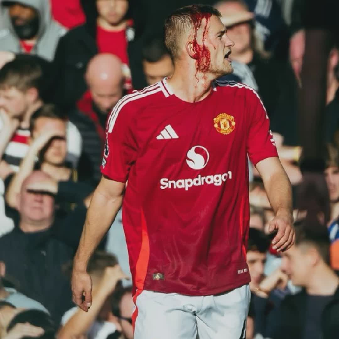 Post by Yohannes Garedew: Wow red devil 😈 #buzzer #fyp #viral #Daily #sports #buzzer_fan_official #football #pivale1141 #trending #rasel6614...