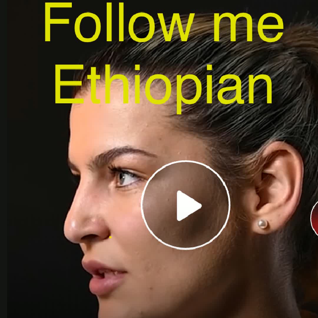 Post by Tz Of: Ethiopian viral @asmarselam83 @mingizembirhan11 @madushsmadushan7788 @natty9 @seifu.g @maht @robajr12356 @mesud2073...