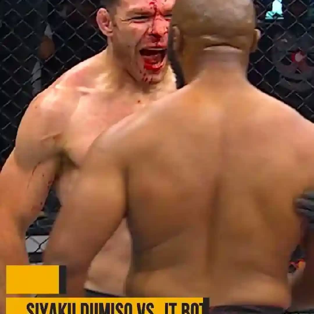 Post by Tekalign Wakgari: Boxing injury @sofiandje9 @nafy_editz @abusaabush40 @nateel @oliyad.ab @hab19 @ethiomastercard @qrn @mulugetatezera4...
