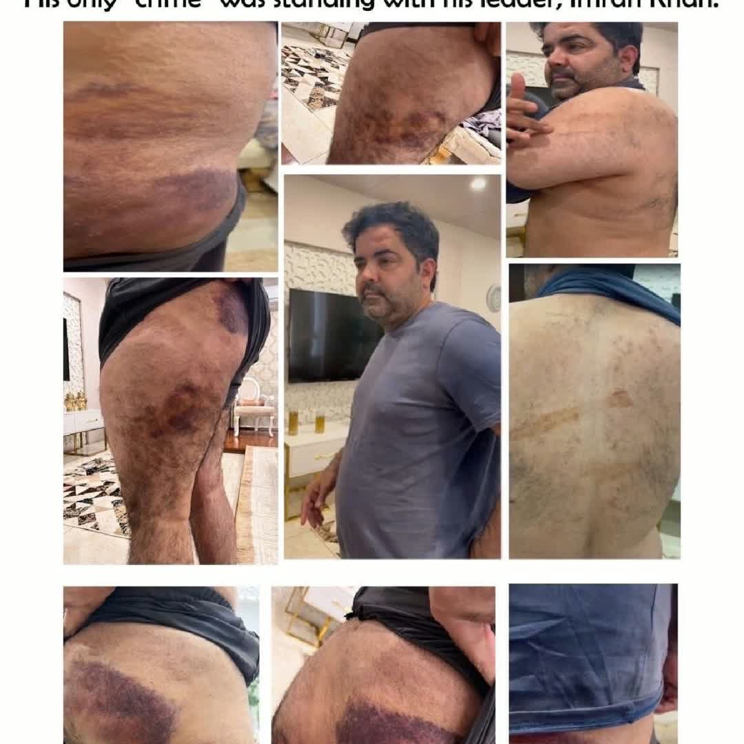Post by Younas 2398: MNA faheem khan per police ka tashadud😥😥😥😥😫😫😫 @championsleague @khel9ice @rokib.com @avneesh1685 @ano...